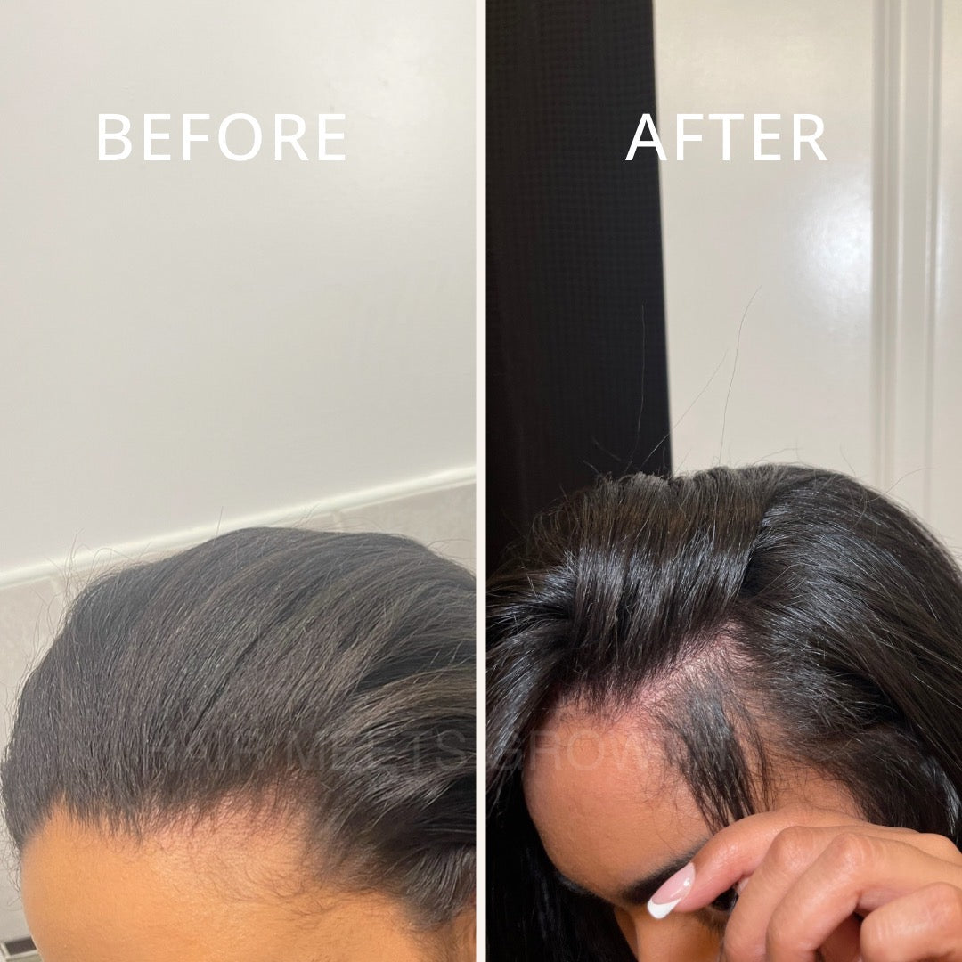 ROSEMARY & MINT HAIR GROWTH OIL